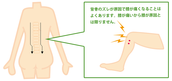 モルフォセラピーとは