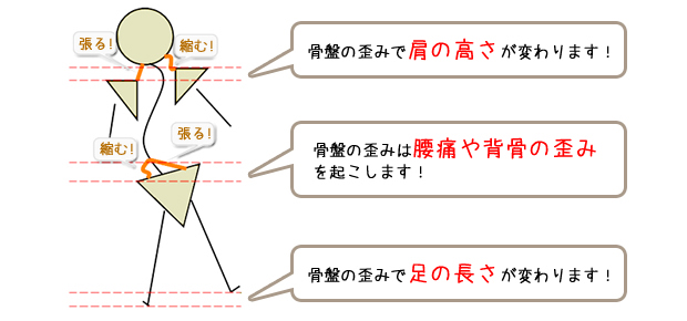 体の歪みに着目しています