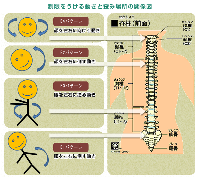 痛みのでる動きに着目しています